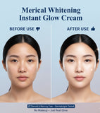 Merical whitining instant glow cream